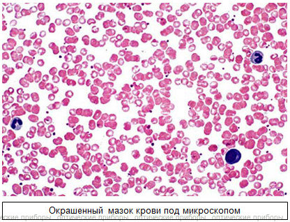 Общий анализ крови с микроскопией